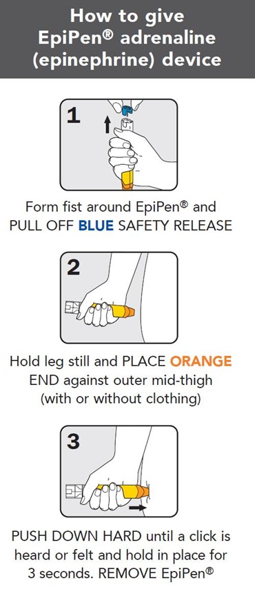 Anaphylaxis guide